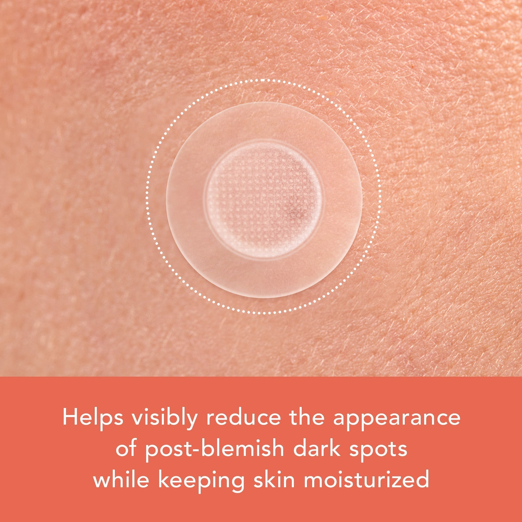 Miracle Patch Microcrystal Vitamin C Dark Spot Cover - Original Collection bC