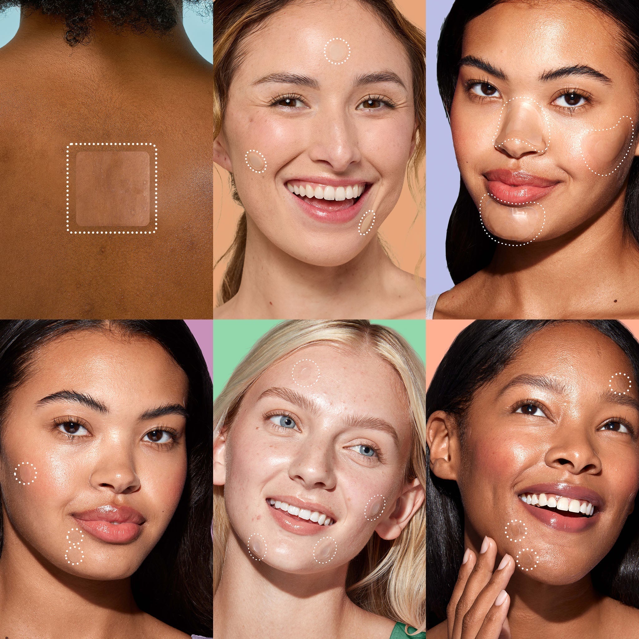 Miracle Patch Ultimate Pimple Patch Kit - Original Collection FJ