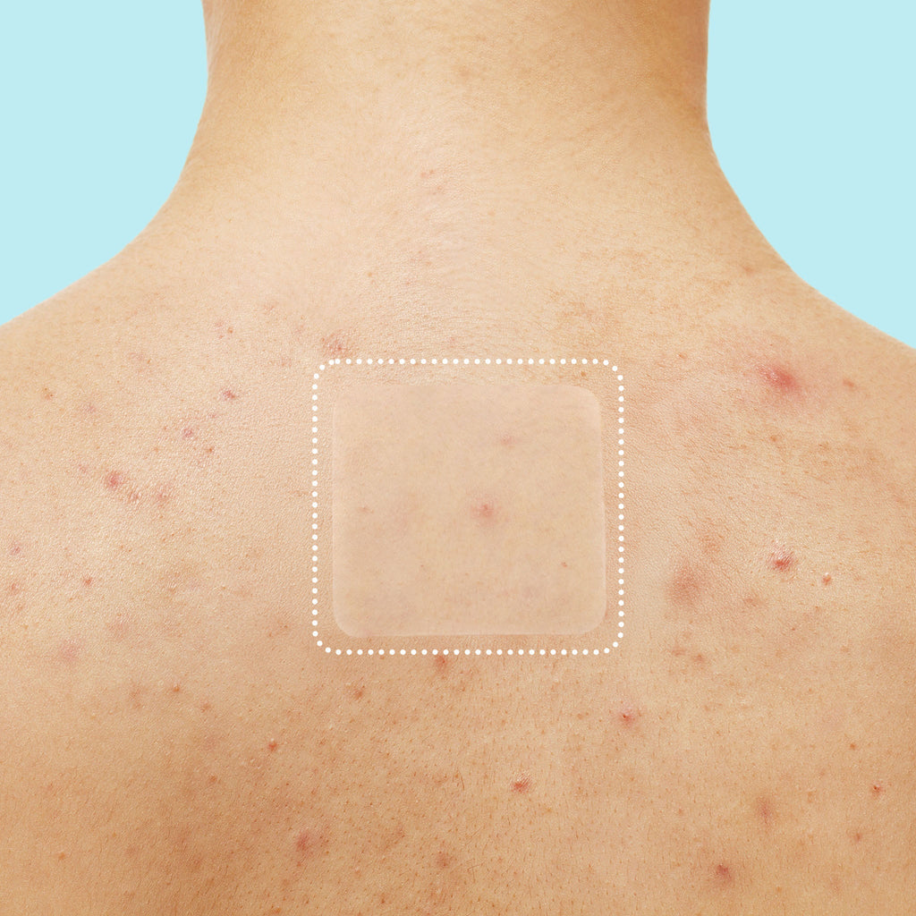 Miracle Patch XL Spot Control Cover - Original Collection dI
