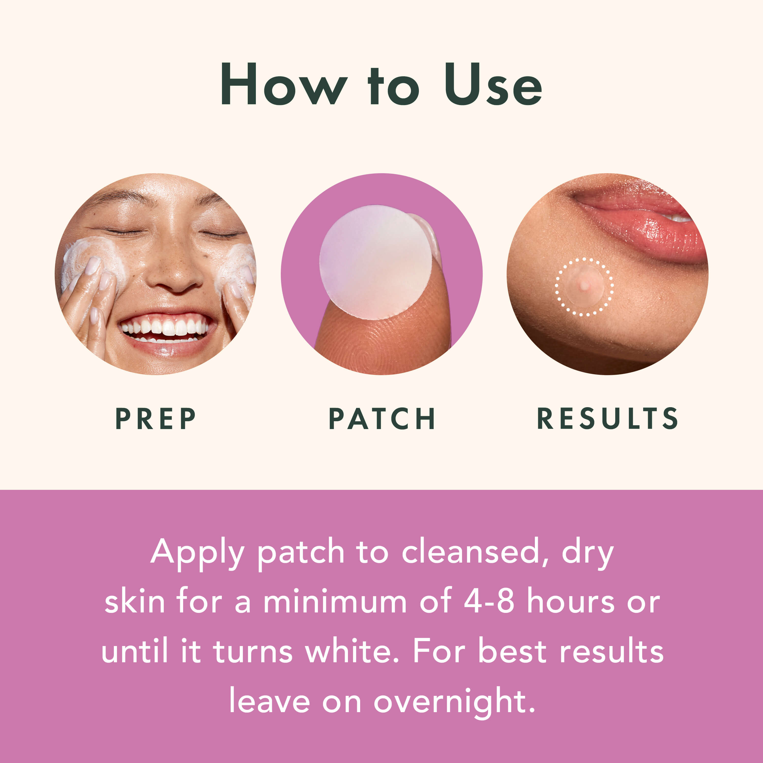 Miracle Patch Overnight Spot Cover - Original Collection Xq